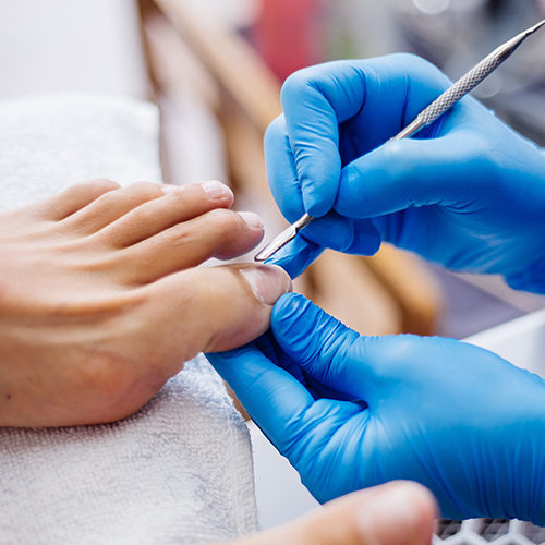 Badanie mykologiczne